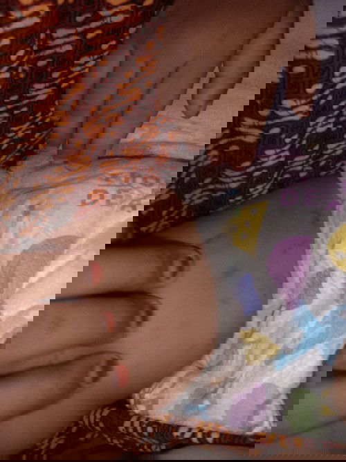 Gatel di selangkangan anak usia 1 thn