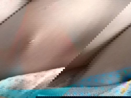 แม่ๆค่ะบ้านไหนน้องเป็นแบบนี้บ้างค่ะน้องมีหัวสีขาวๆในหัวนมค่ะไม่มีอาการเจ็บไม่ปวดค่ะ​