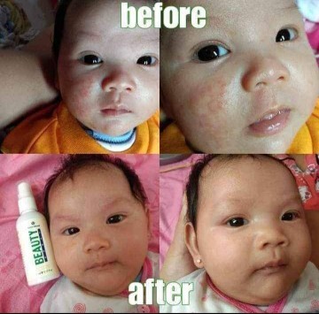 Produk aman untuk bumil dan busui bayi dan balita maupun wanita dan pria 😊