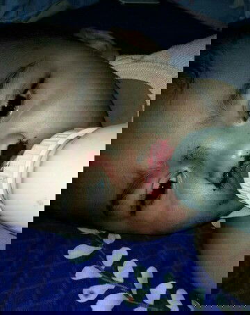 Hidung anak keluar darah