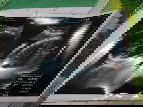 36 weeks Mau tanya dong