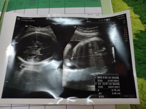 36 weeks Mau tanya dong