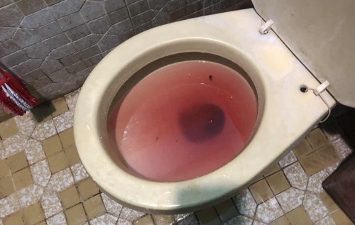 HEAVY BLEEDING 13weeks pregnant