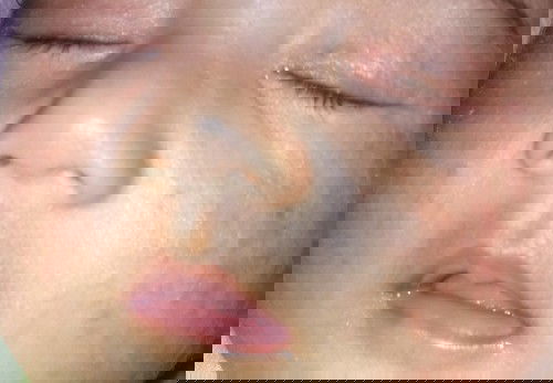 Biang keringat pada bayi 1 bulan