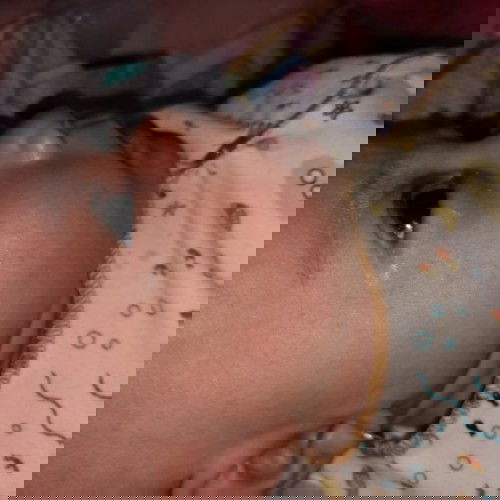 Mengatasi bintik bintik mera di wajah dan telinga