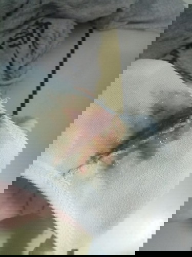 มีมูกเลือดไปรพ.ได้เลยไหมคะ