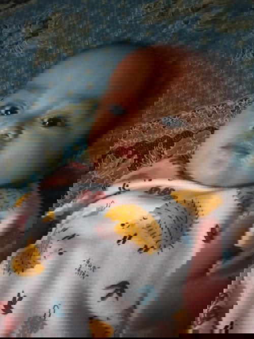 Merah sebadan setelah demam turun