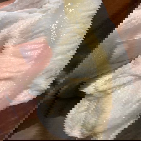 มีมูกแบบนี้แต่ไม่มีเลือด ต้องไปหาหมอไหมค่ะ 38+6