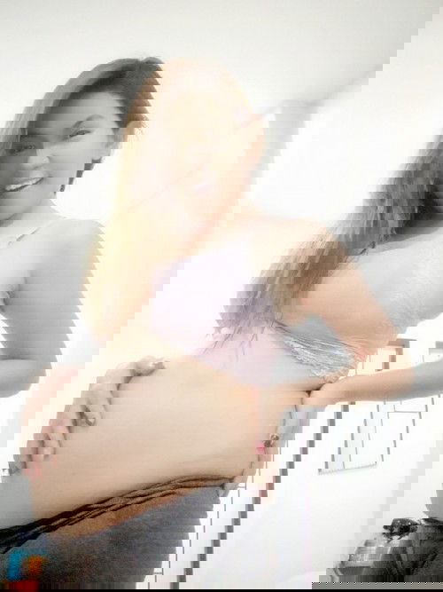 ตั้งครรภ์ วัย 35+ พาหะธาลัสซีเมีย 
21W