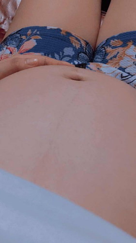 Bawal po ba sa pregnant ang kumain ng talong?