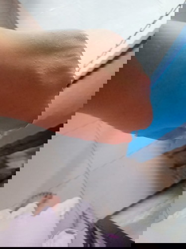 Có m nào đang có bầu mà nắng nóng nổi sảy giống e k ngứa quá trời ai có gì trị k giúp e với