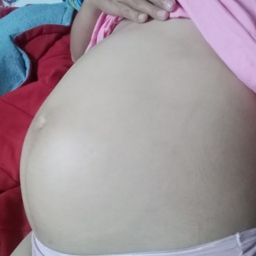33w กำหนด18สิงหาคม น้ำหนักขึ้นมา17กิโลคุณแม่ๆว่าขึ้นมาเยอะไปหรือเปล่าค่ะ แม่ๆท่านอื่นขึ้นกันกี่โลจ้า