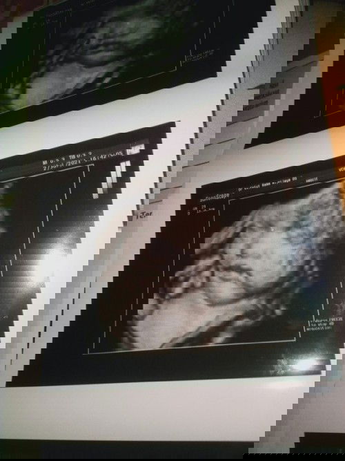 Happy 7 mounth 🥰🥰