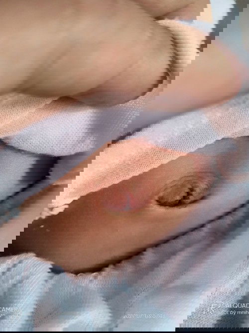 Normal lang po ba ito ??