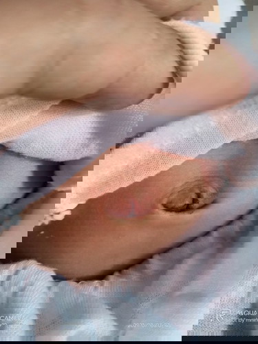 Normal lang po ba ito ??