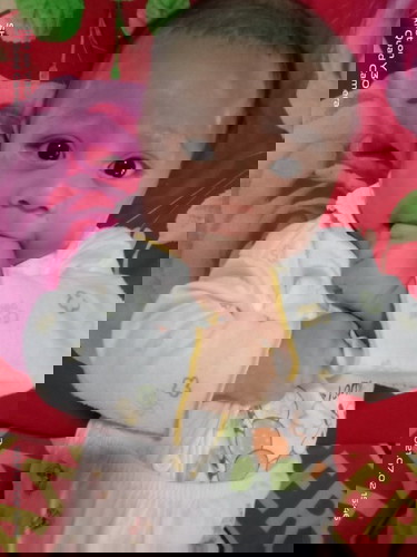 Bun, mau tanya . Anaku umur 3 bulan kok sekarang rewel ya . Apa karna mau bisa tengkurap jadi rewel