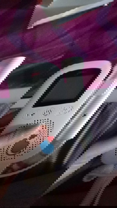 Ultrasound Doppler Fetal