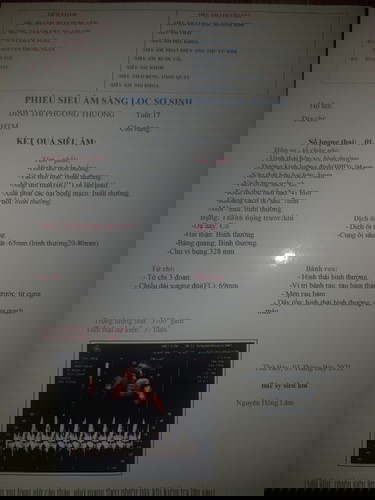 Góc xin ý kiến