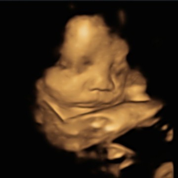 Semoga persalinan lancar 🤲