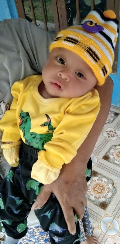 Muntah sampai kehidung pada bayi