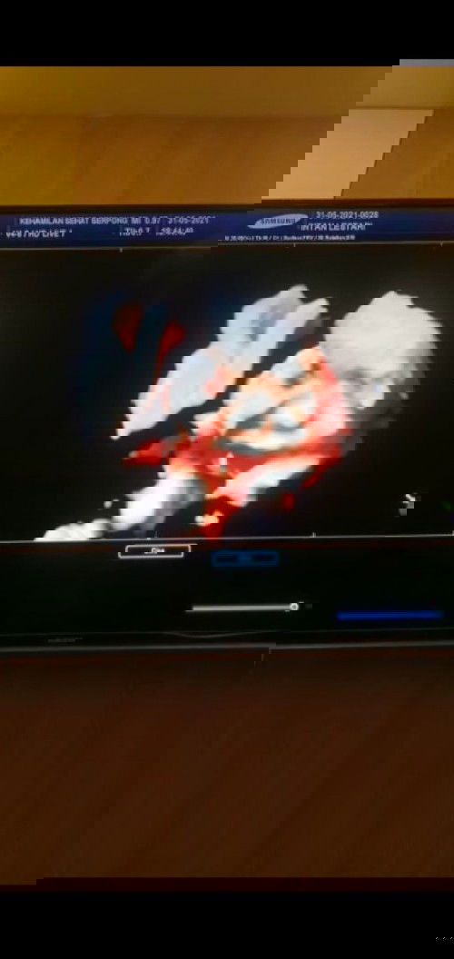 intanlestarimanalu546@gmail.com