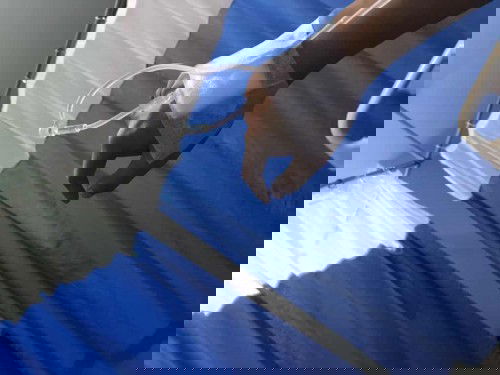 Opname ke 2x karna HEG