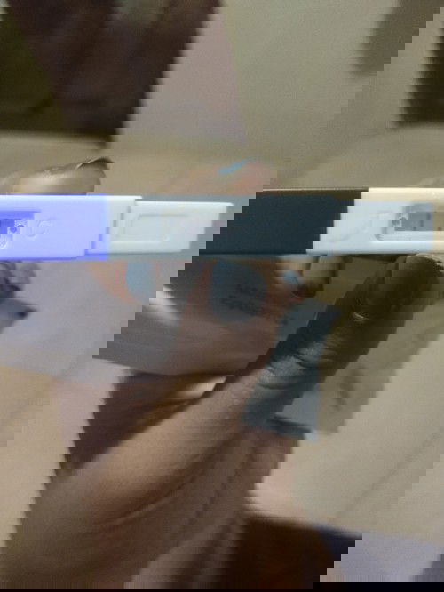 อาการแพ้ท้อง