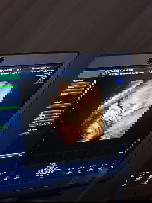 HPL AGUSTUS 🥰🥰🥰