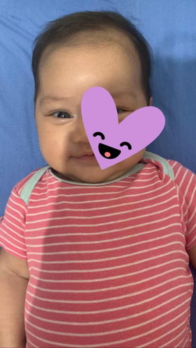 Rekomendasiin skin care baby dong bun hihi