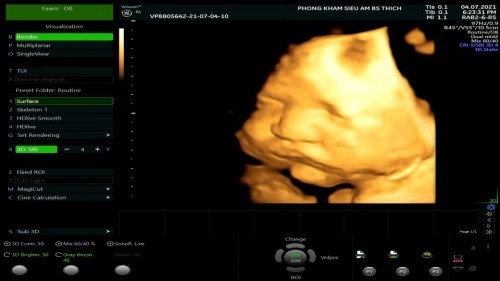 36w3d bé đc 3012gr vậy đã được chưa các mom