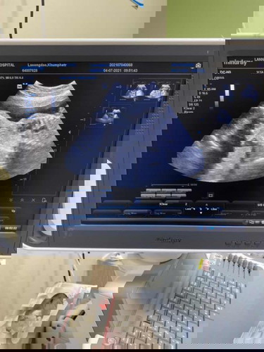 24+3 วีค น้ำหนักน้องเท่าไรกันบ้างคะ บ้านนี้ 811 กรัมค่ะ