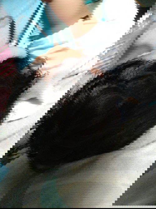 shape ng ulo ni baby