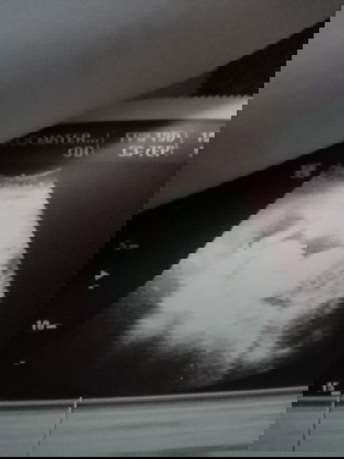 mga momshie ano po kaya sa palagay niyo ang gender ni baby ko, 2nd baby and excited lang po kasi ako