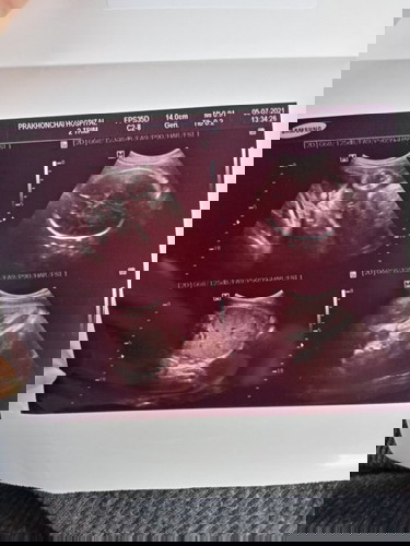 สอบถามแม่ๆหน่อยค่ะ