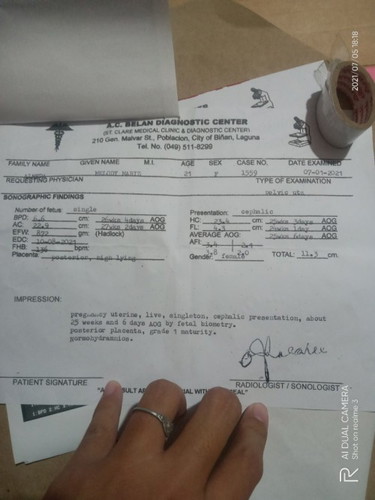 Normal lang po ba?