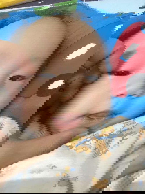 จุดสีขาวริมฝีปากคืออะไร?