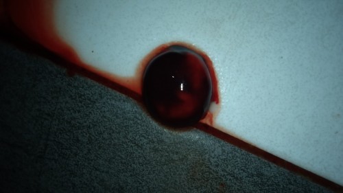 Bleeding 8weeks