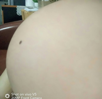 34w 19สิงหาคม