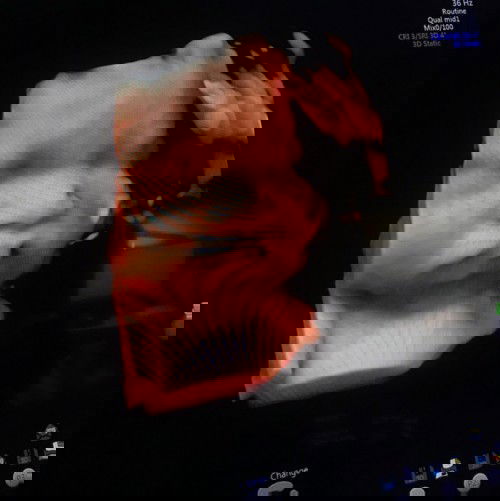 38 tuần 4 ngày 3400g