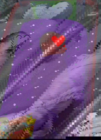 Sukses vbac, bonus tanpa jaitan juga