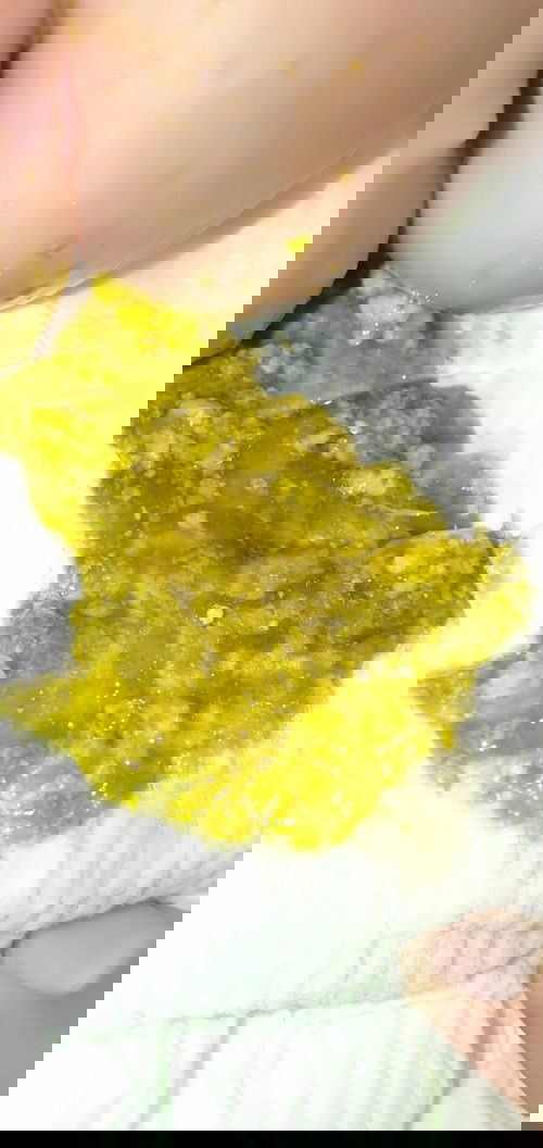 Bab bayi 1bulan  berlendir hijau... Setiap bis nyusu BAB apakah normal....