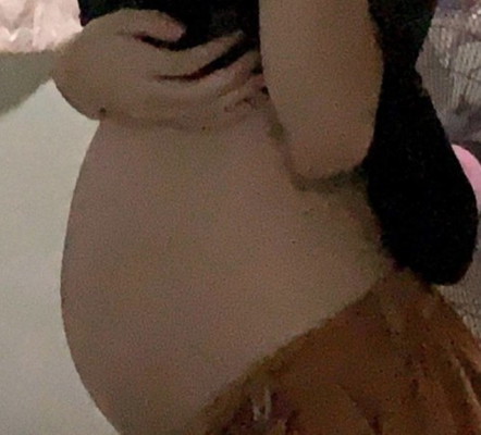 ทำไมท้องเล็กจังเลยคะ มีใครเป็นบ้าง?