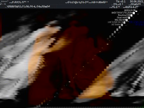 Hamil 30w bayi masih belum turun ke bawah