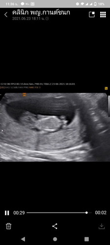 อยากได้ผู้หญิง...แม่ๆ ว่ามีลุ้นมั้ยค่ะ