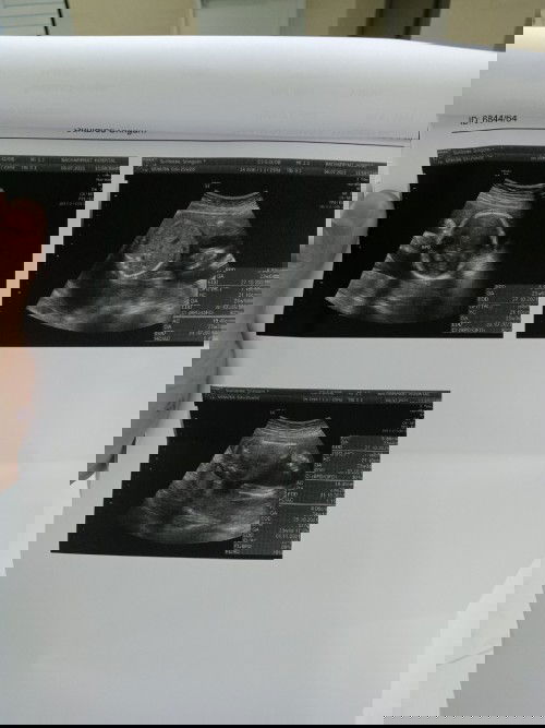 สอบถามหน่อยคะ