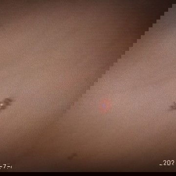 Obat melenting pada bayi