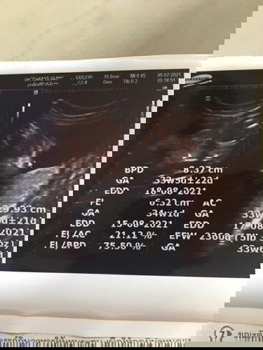 ไปชาว์มาเมื่อวานคะ