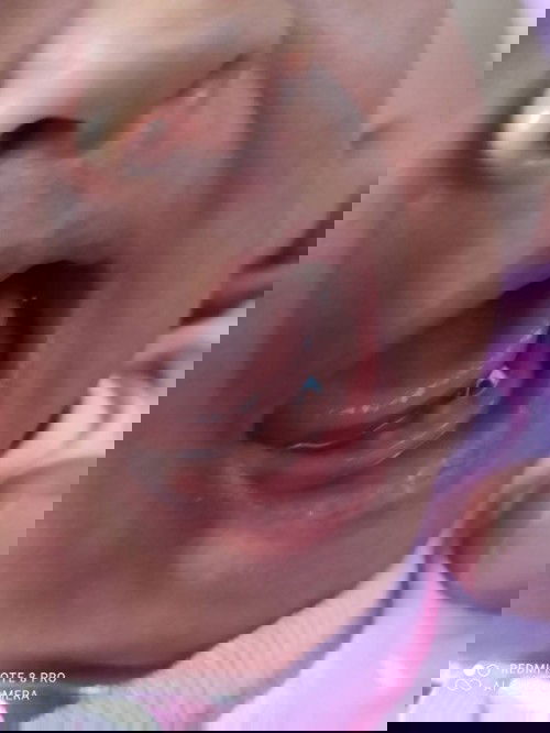 น้องมีฟัน.