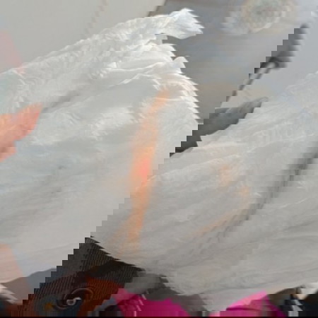 มีเมือกปนเลือดออกมาแบบนี้คืออะไรคะขอความรู้จากแม่ๆทุกท่านหน่อยค่ะ