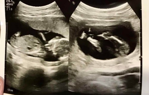 15week ญ หรือ ช